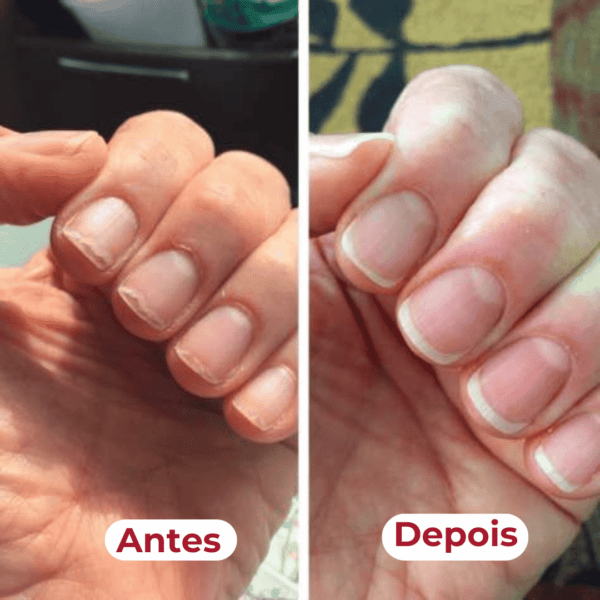 Antes e depois: unhas mais fortes e resistentes
